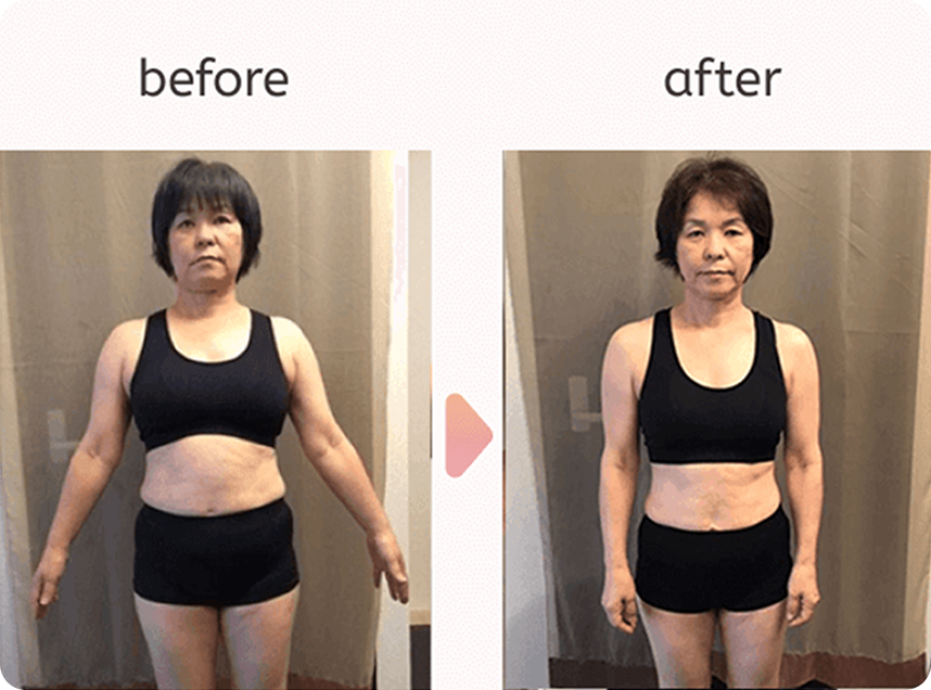 Before After 3
